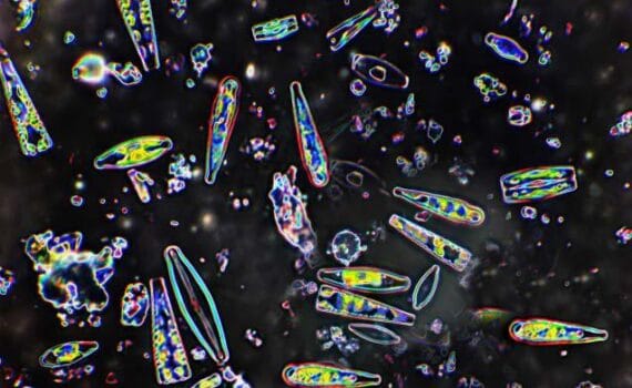 Microbial Growth in Shrimp Ponds